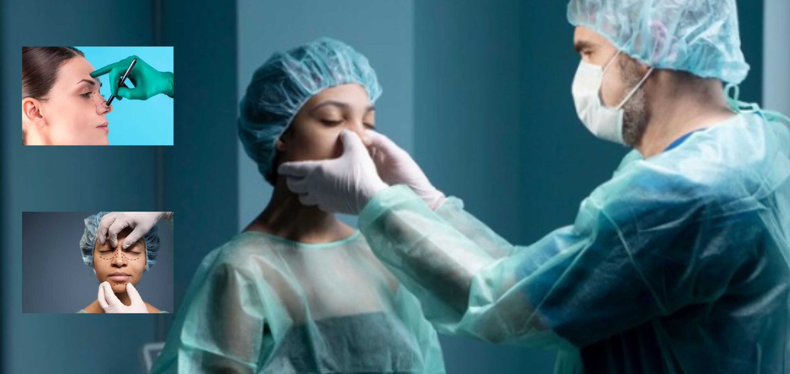 ¿Cuánto cuesta una operación de la Nariz? «RINOPLASTIA»