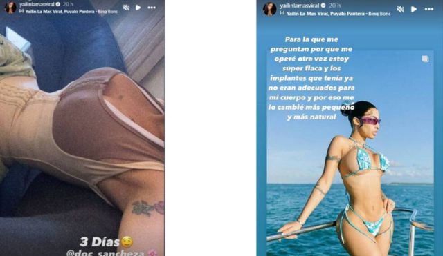 yailin la mas viral cirugias